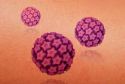 Más del 90% de hombres y del 80% de mujeres activos podrían ser infectados por un tipo de VPH alguna vez en sus vidas