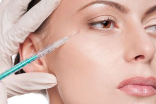 ¿El bótox es para mí?