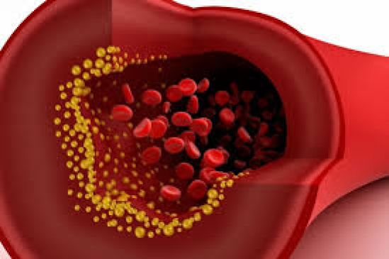 Lanzan iniciativa para conocer los niveles de de colesterol en la sangre