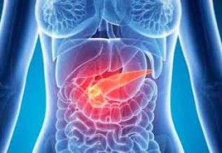 Investigadores de Mayo Clinic identifican gen que predeciría cáncer pancreático en personas con diabetes tipo II