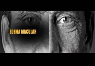 Más del 94% de casos mal atendidos de retinopatía diabética o edema macular podrían generar ceguera