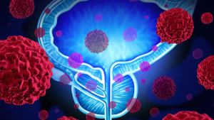 Alrededor del 60% de los casos de cáncer en México es detectado en etapas avanzadas: especialista