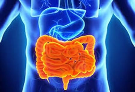 El Síndrome de Intestino Irritable (SII), padecimiento más común en mujeres