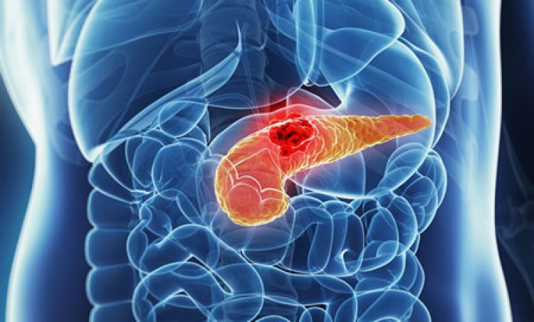 Crean anticuerpos para luchar contra cánceres altamente agresivos