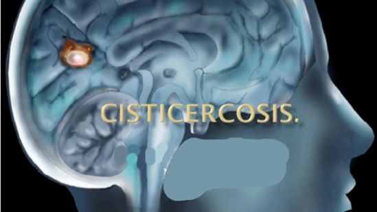 Tratamiento hormonal, una alternativa para controlar cisticercosis, investigadora del Cinvestav