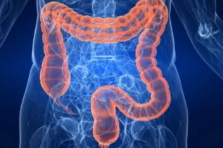 Síndrome de Intestino Irritable, un enemigo persistente y doloroso