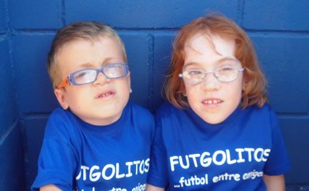 Acceso efectivo al tratamiento, necesidad de los pacientes con Síndrome de Morquio