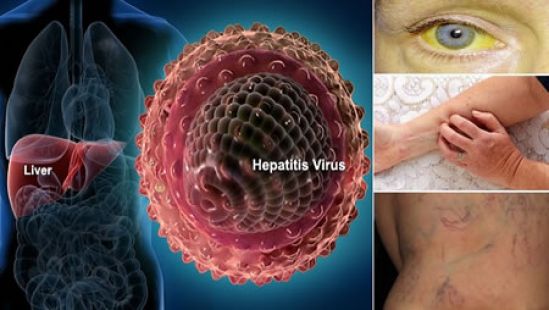 Se busca la eliminación de las hepatitis en el mundo