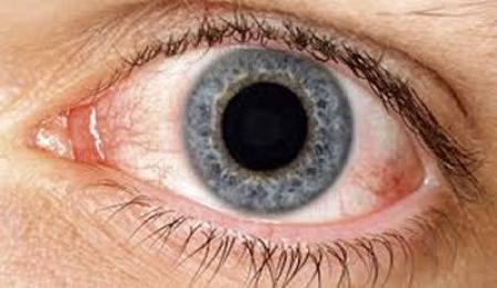 Novartis refuerza su oferta de tratamientos para pacientes con ojo seco