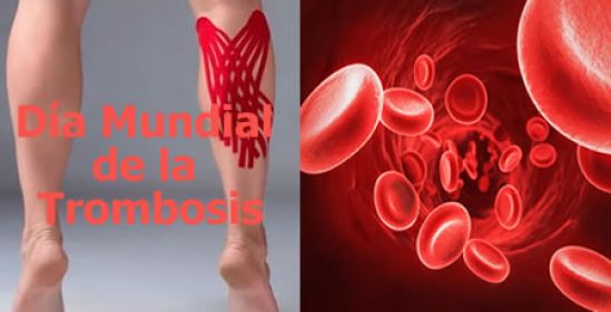 Especialistas recomiendan más movimiento para prevenir la trombosis