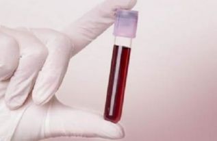 Científicos del Cinvestav logran modificación a la Norma para Bajar el Nivel de Plomo en la Sangre