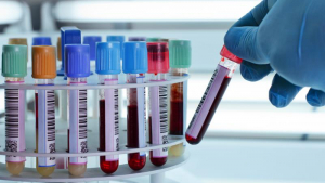 Claves para enfrentar contingencias en la industria farmacéutica
