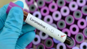SARS-COV-2 y las nanopartículas producto de la contaminación, tienen mucho en común para dañar el cerebro.