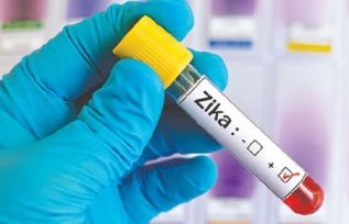 Siemens lanza nueva prueba para la detección del virus Zika