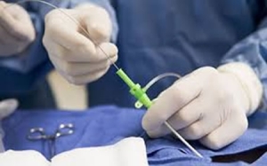 Evolución en el cáncer cervicouterino temprano: Cirugía radical abierta vs cirugía mínimamente invasiva