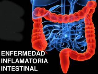 Biofarmacéutica reúne a médicos especialistas para discutir sobre las Enfermedades Inflamatorias Crónicas