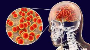 Día Mundial contra la Meningitis: un día hace la diferencia