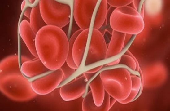 Inhibidores: mayor desafío para el tratamiento de la hemofilia