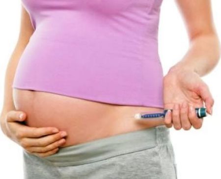 Abbott realiza encuentro para pacientes con diabetes tipo 1, dialogaron sobre los retos de vivir con la enfermedad