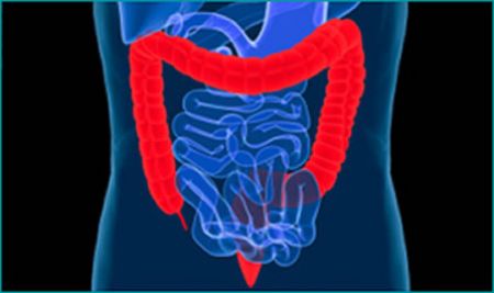 La vida de un paciente con cáncer colorrectal