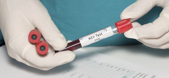 OPS insta a hacerse la prueba de VIH como primer paso para prevenir el sida y detener la epidemia