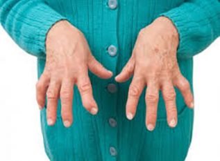 ¡Qué la artritis no te discapacite!