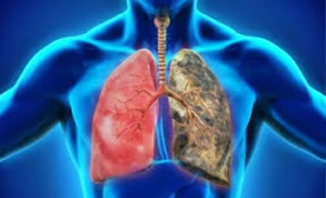Investigadora desarrolla el primer dispositivo médico para prevenir muertes por Enfermedad Pulmonar Obstructiva Crónica