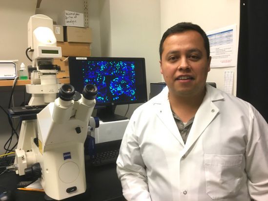 Una proteína epitelial podría cambiar en el futuro la forma de combatir el cáncer