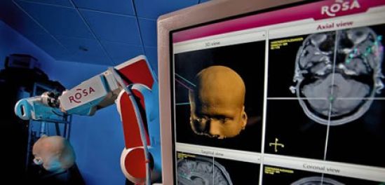 Innovador robot estereotáctico está ampliando las opciones quirúrgicas de la epilepsia