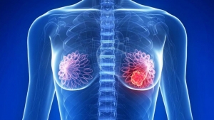 Conocimiento, principal arma contra el cáncer
