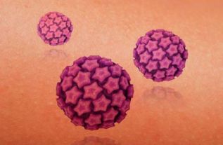 OPINIÓN :: La vacuna contra VPH debe aplicarse en jóvenes para prevenir cáncer cervicouterino y otras enfermedades asociadas al virus