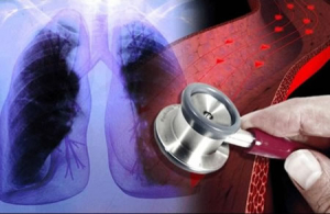 Hipertensión arterial pulmonar: poner en pausa el tratamiento puede afectar la expectativa de vida del paciente