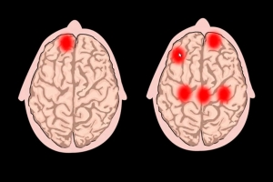 Estudio global revela que en México, cada nueva generación tiene un mayor deterioro mental que la anterior