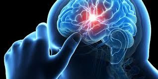 ¿Cómo actuar ante un Accidente Cerebro Vascular?