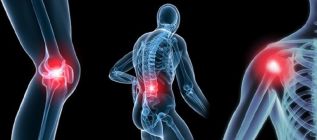 Un nuevo fármaco, apoyado por FIPSE, arroja luz en el tratamiento de la osteoartrosis degenerativa