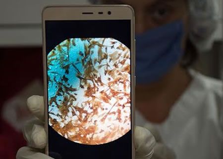 En el HIMFG se desarrolla técnica de regeneración celular para reconstrucción de vagina 