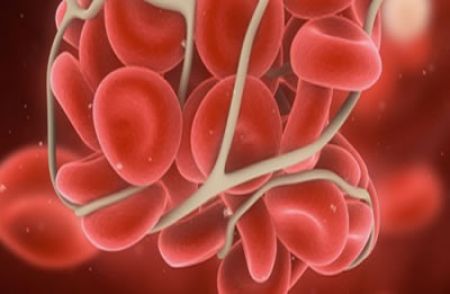 Nueva terapia reduce entre 87 y 99% hemorragias en pacientes con hemofilia