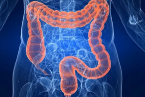 OPINIÓN :: Síndrome de Intestino Irritable