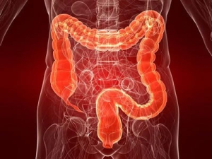 El cáncer colorrectal no es el único cáncer gastrointestinal que está aumentando entre los adultos jóvenes