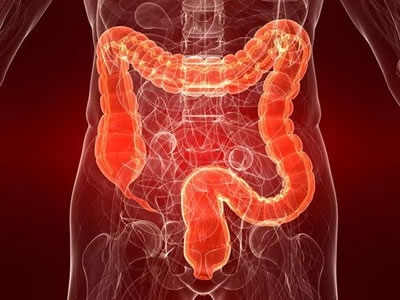 El cáncer colorrectal no es el único cáncer gastrointestinal que está aumentando entre los adultos jóvenes