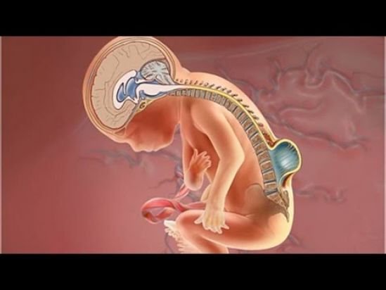 Mejorando la calidad de vida en pacientes con Espina Bífida