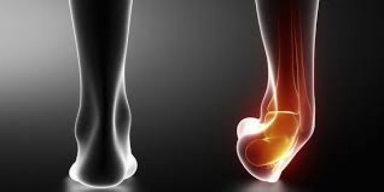 Primeros auxilios para un esguince   