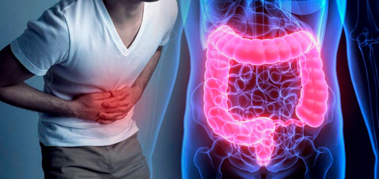Más de 30% de los pacientes con enfermedad inflamatoria intestinal presentan depresión y ansiedad moderada