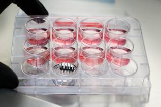Electroquimioterapia, método para la administración específica de fármacos orientados a combatir las neoplasias en mamas