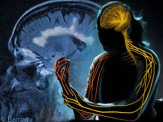 FDA apueba ocrelizumab en Estados Unidos