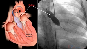 La importancia de mantener un corazón sano, nuevas tecnologías para lograrlo