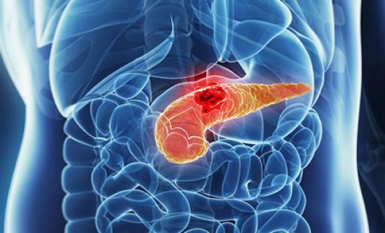 Divulgan avances en el tratamiento de cáncer de páncreas
