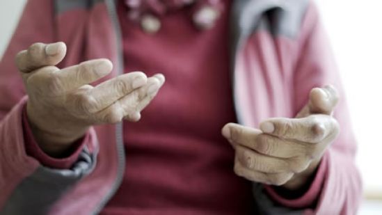 Personas con artritis utlizan lenguaje de señas como terapia de rehabilitación