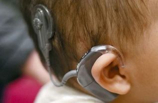 En México alrededor de 10 millones de personas padecen algún grado de sordera