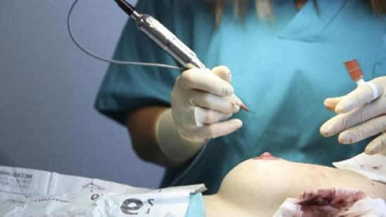 En México 16 mujeres fallecen diariamente a causa del cáncer de mama